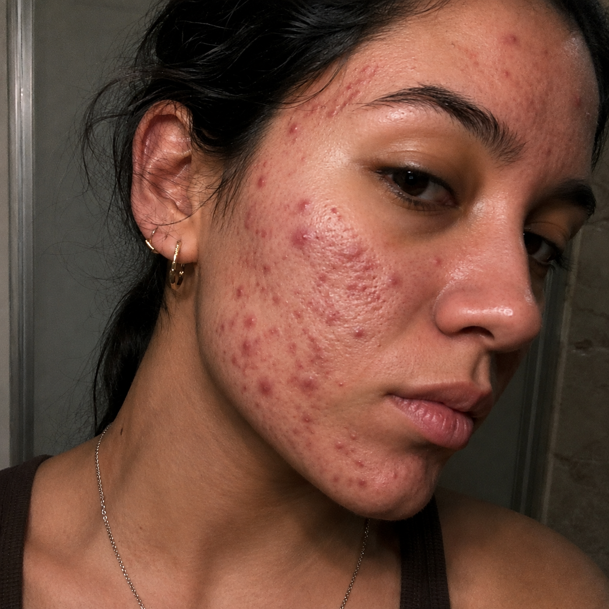 BLUNE™ | Votre Rituel Anti-Imperfections Quotidien